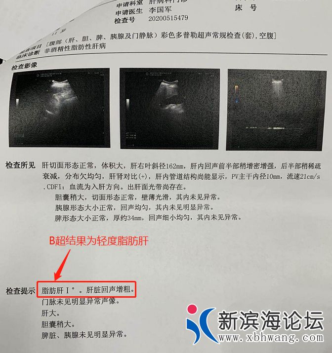 微信图片_20200620143422.png