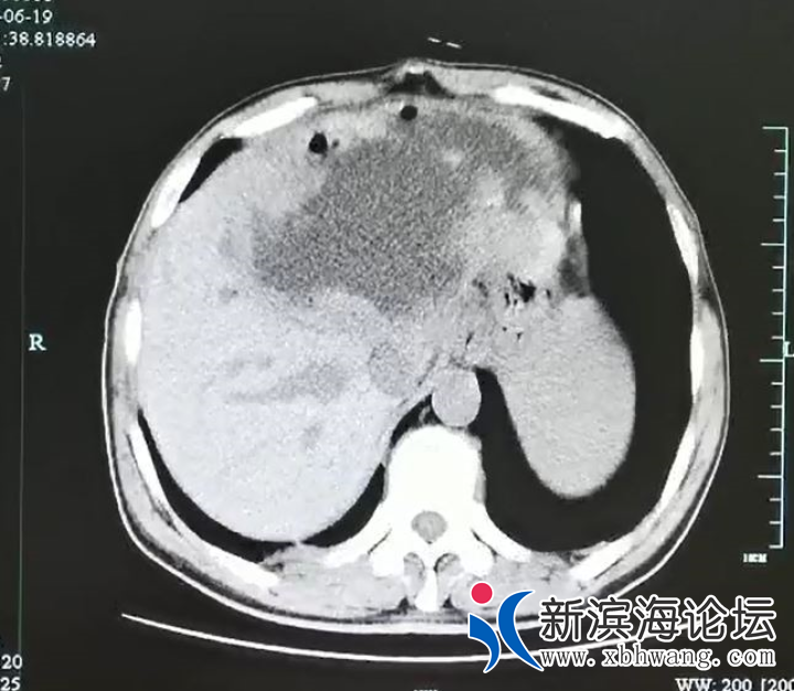 微信图片_20200720150909.png